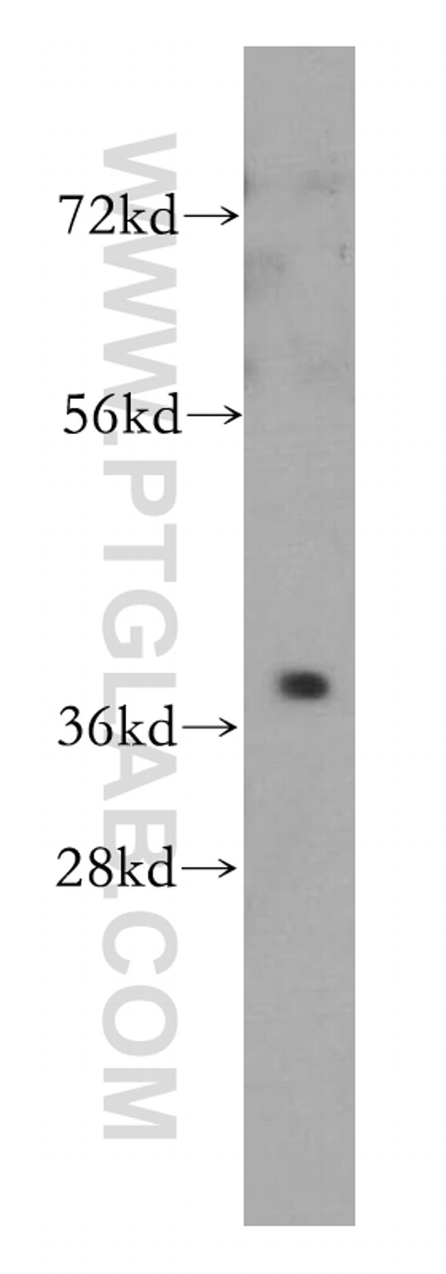 PTGR2 Antibody in Western Blot (WB)