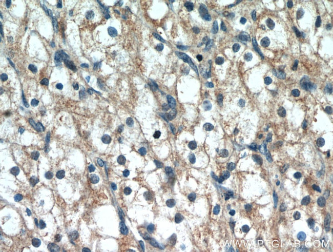 PTH2R Antibody in Immunohistochemistry (Paraffin) (IHC (P))