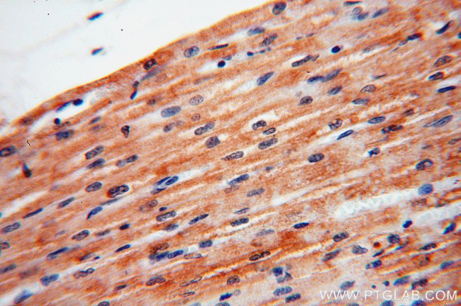 XPR1 Antibody in Immunohistochemistry (Paraffin) (IHC (P))