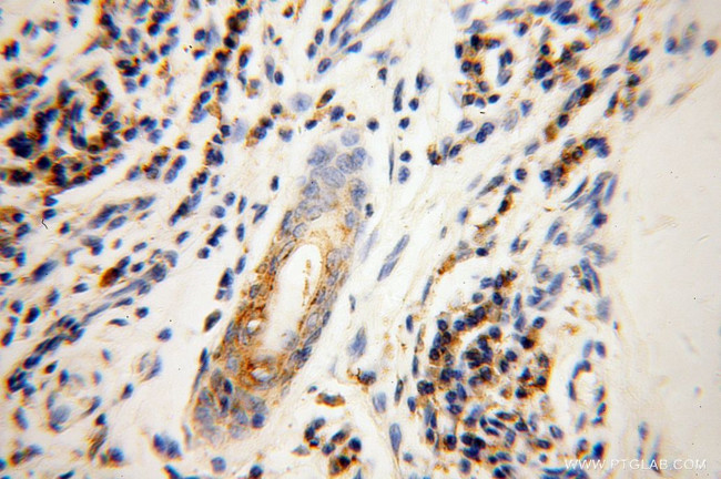 GK3P Antibody in Immunohistochemistry (Paraffin) (IHC (P))