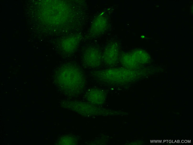 SMC5 Antibody in Immunocytochemistry (ICC/IF)