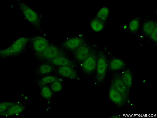 SMC3 Antibody in Immunocytochemistry (ICC/IF)