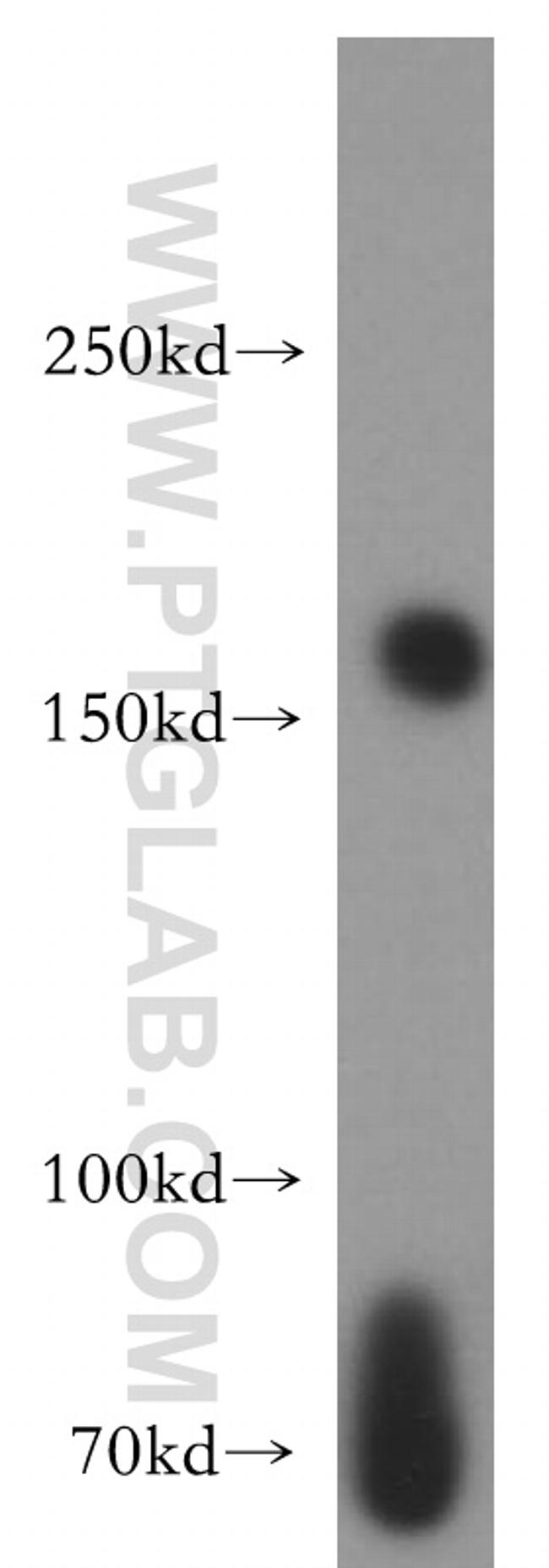 NUP153 Antibody in Western Blot (WB)
