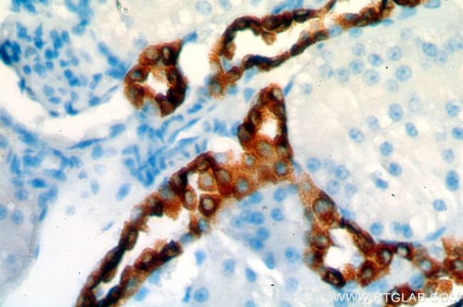 HSD11B2 Antibody in Immunohistochemistry (Paraffin) (IHC (P))