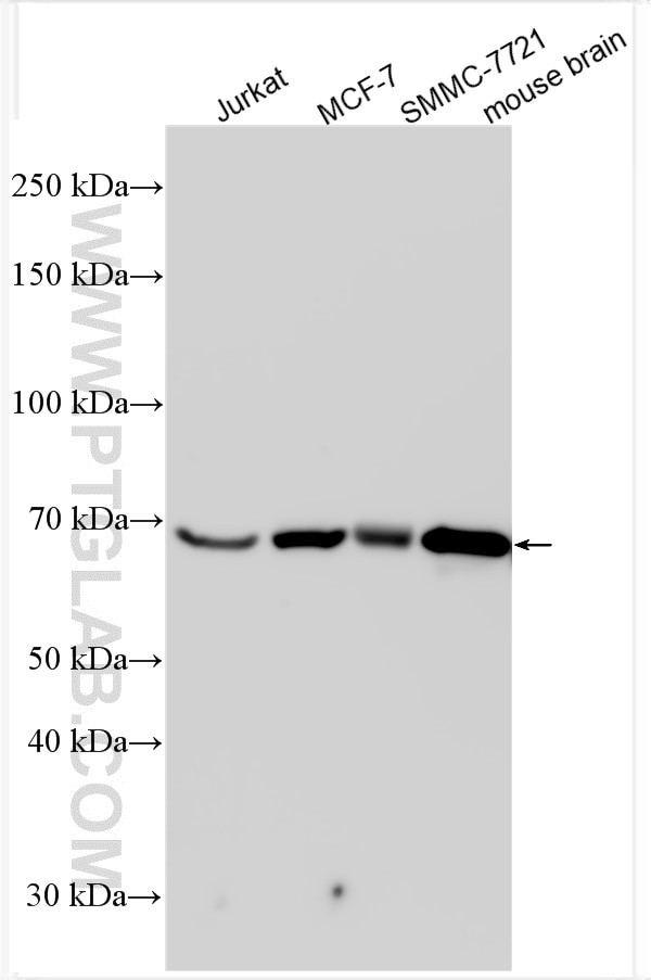 B3GNT2 Antibody in Western Blot (WB)