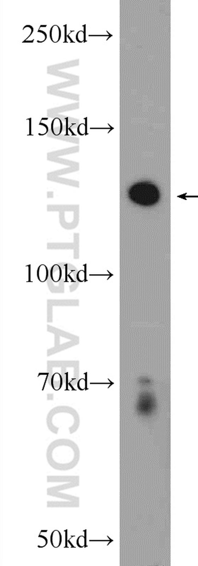 PLEKHH2 Antibody in Western Blot (WB)