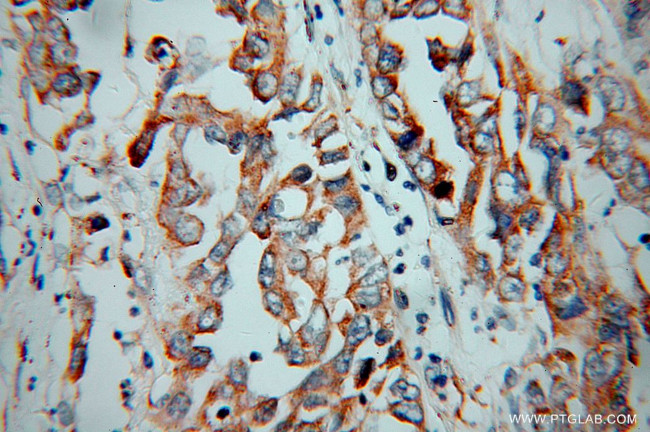 KChIP1 Antibody in Immunohistochemistry (Paraffin) (IHC (P))
