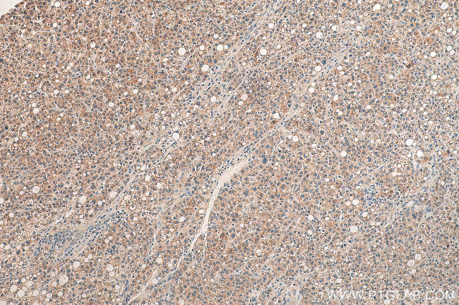 CCL14 Antibody in Immunohistochemistry (Paraffin) (IHC (P))