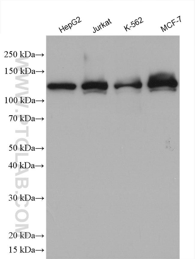 RABGAP1 Antibody in Western Blot (WB)
