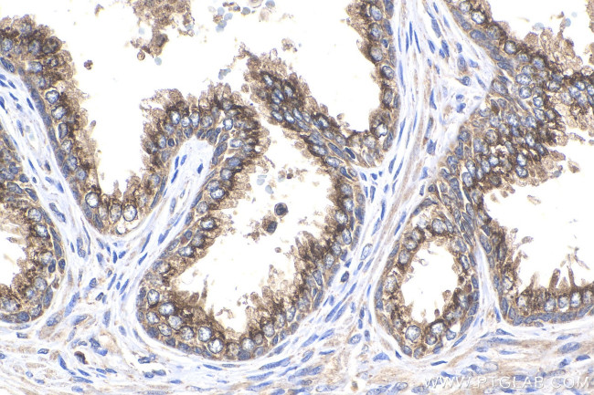Prostein Antibody in Immunohistochemistry (Paraffin) (IHC (P))