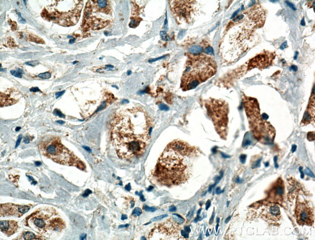 PLCD1 Antibody in Immunohistochemistry (Paraffin) (IHC (P))
