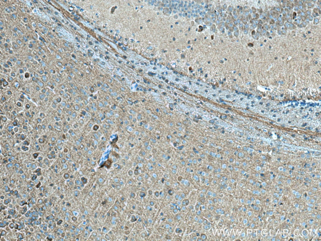 Kv1.2 Antibody in Immunohistochemistry (Paraffin) (IHC (P))