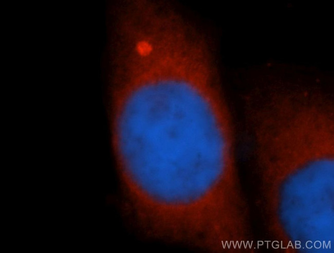 GCLM Antibody in Immunocytochemistry (ICC/IF)