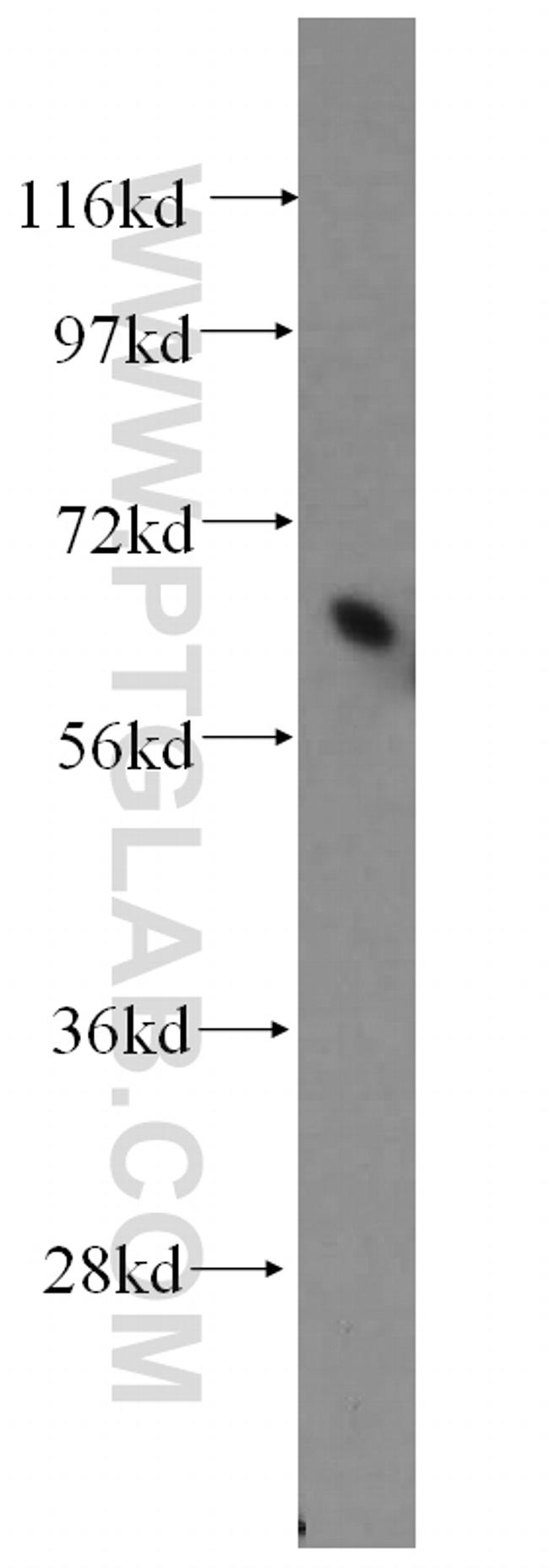 PIAS4 Antibody in Western Blot (WB)