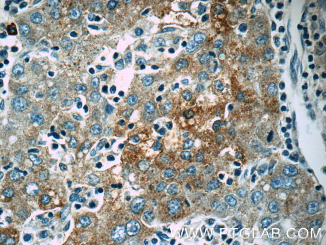 Autotaxin Antibody in Immunohistochemistry (Paraffin) (IHC (P))