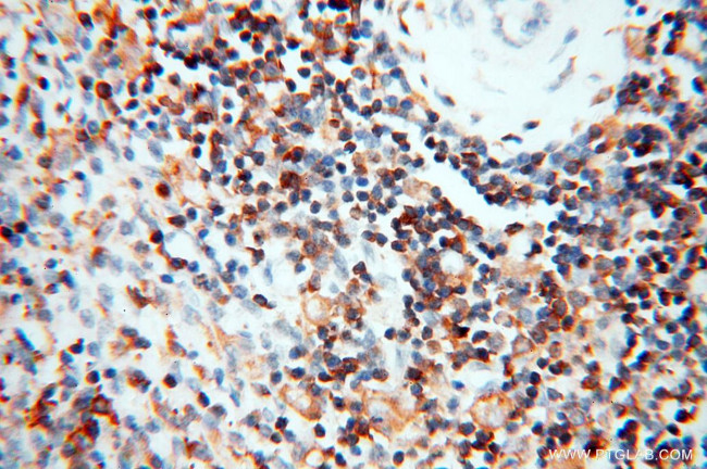 BIN2 Antibody in Immunohistochemistry (Paraffin) (IHC (P))