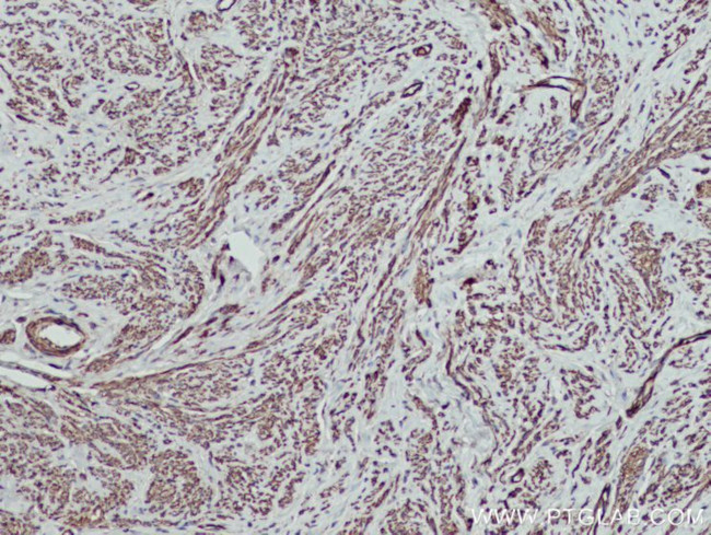 MYL5 Antibody in Immunohistochemistry (Paraffin) (IHC (P))