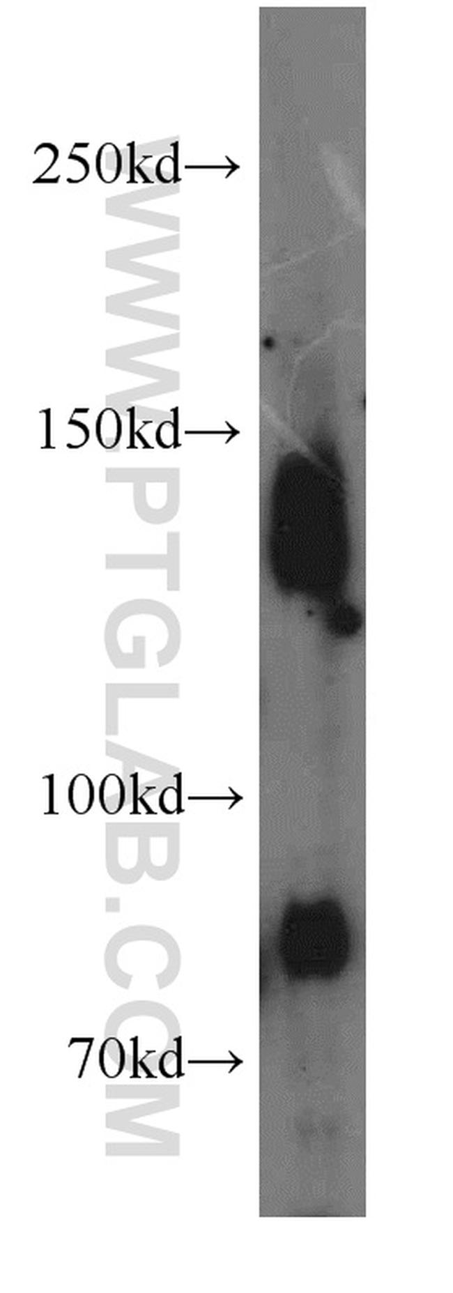 CENPC Antibody in Western Blot (WB)