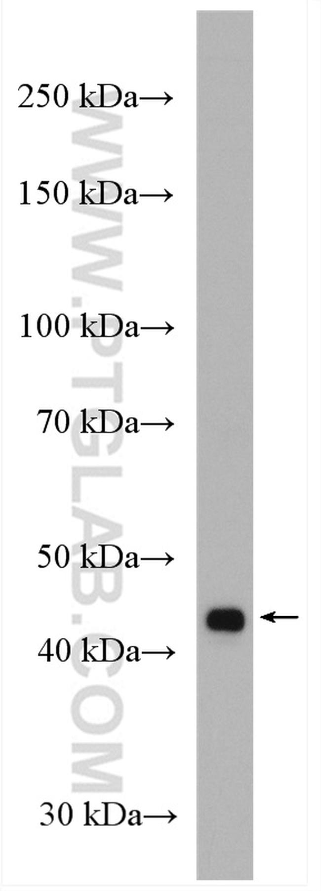 VPS36 Antibody in Western Blot (WB)