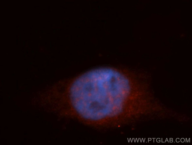 ITPKC Antibody in Immunocytochemistry (ICC/IF)