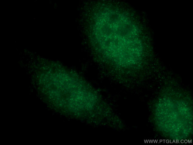 CEBPE Antibody in Immunocytochemistry (ICC/IF)