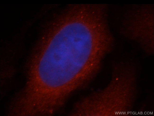 COG6 Antibody in Immunocytochemistry (ICC/IF)