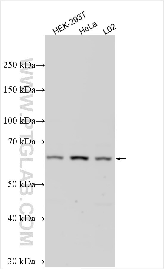SUPT3H Antibody in Western Blot (WB)