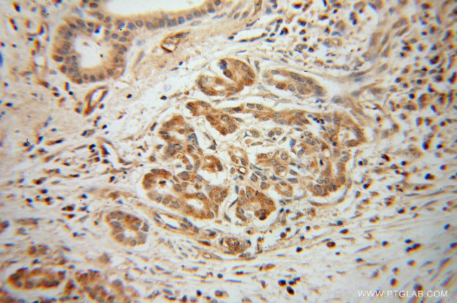 ARHGDIG Antibody in Immunohistochemistry (Paraffin) (IHC (P))