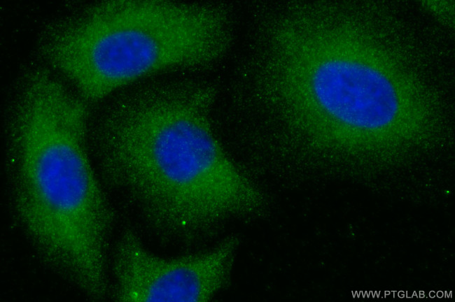 SFRP5 Antibody in Immunocytochemistry (ICC/IF)