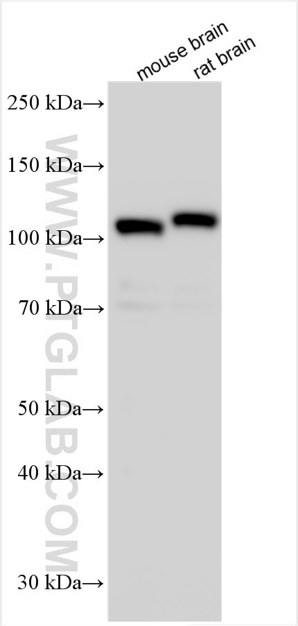 DPP6 Antibody in Western Blot (WB)