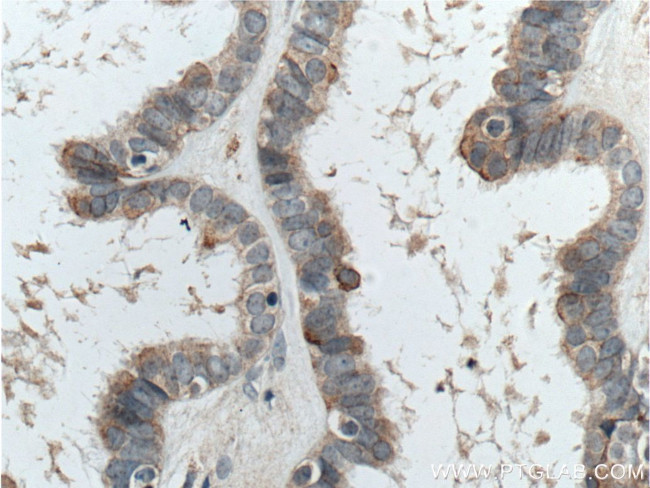 CTSO Antibody in Immunohistochemistry (Paraffin) (IHC (P))
