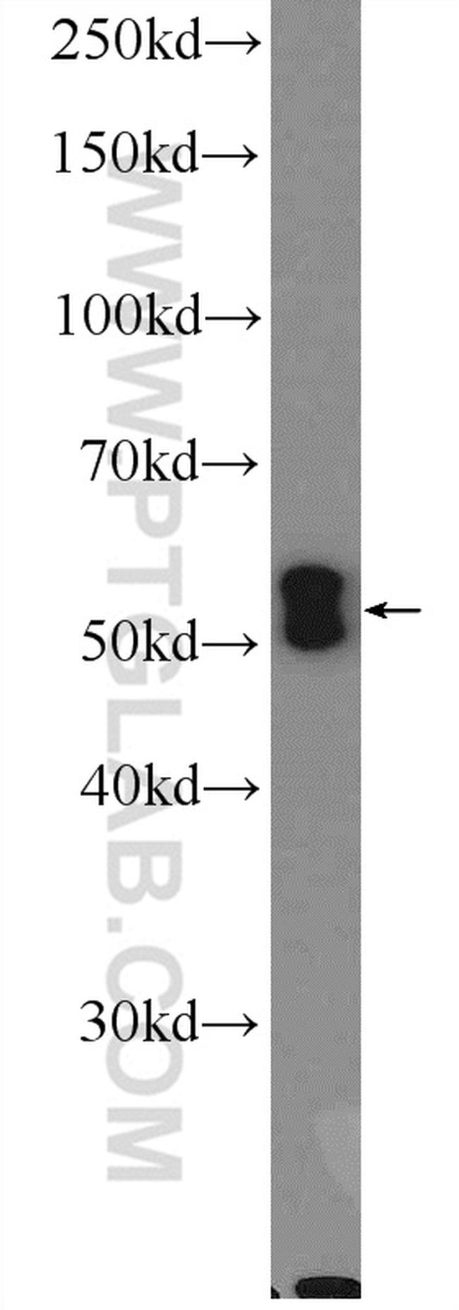 SCRN1 Antibody in Western Blot (WB)