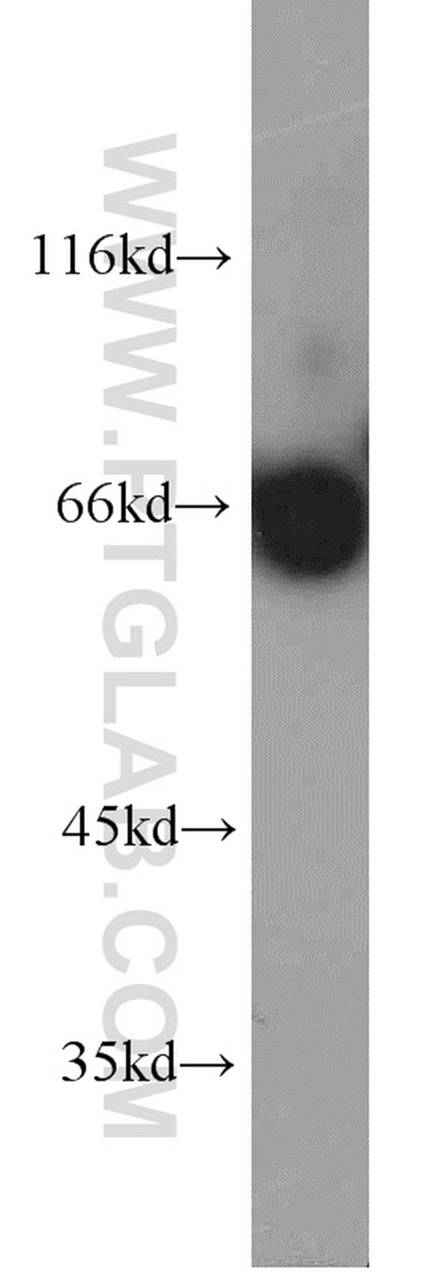 GAN Antibody in Western Blot (WB)