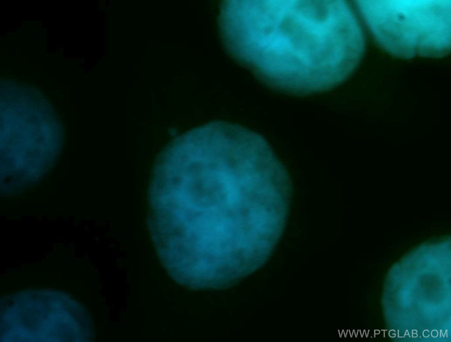 CDC16/APC6 Antibody in Immunocytochemistry (ICC/IF)
