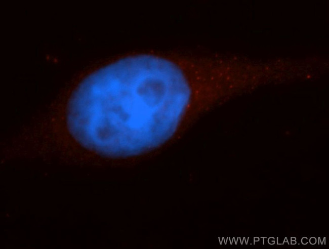 Caspase 10/p23/17/p12 Antibody in Immunocytochemistry (ICC/IF)
