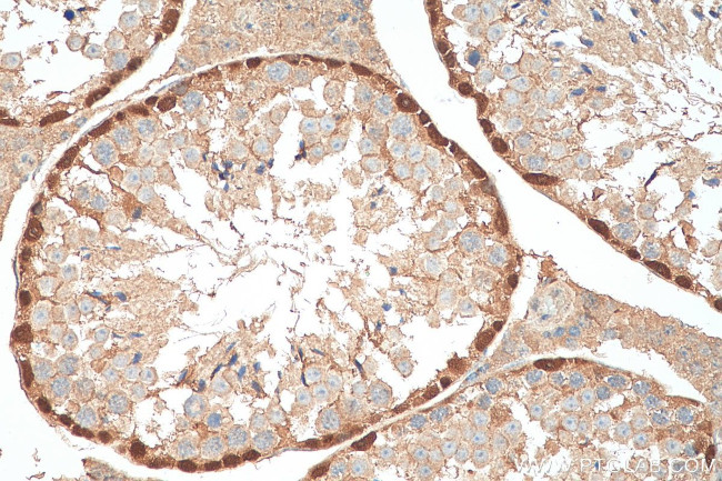 DMRT1 Antibody in Immunohistochemistry (Paraffin) (IHC (P))