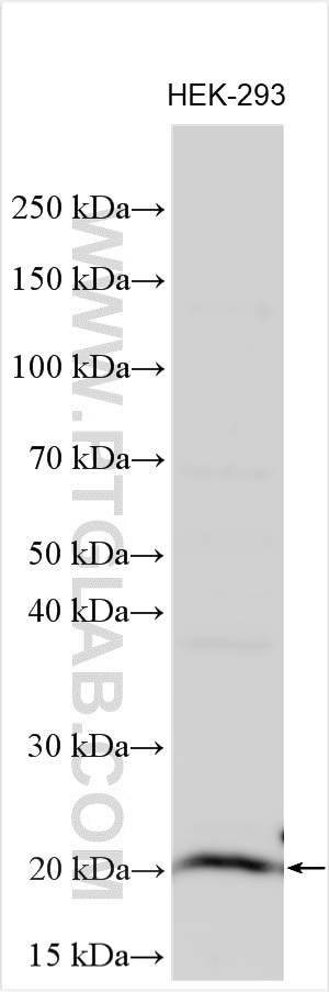 RPS19BP1 Antibody in Western Blot (WB)