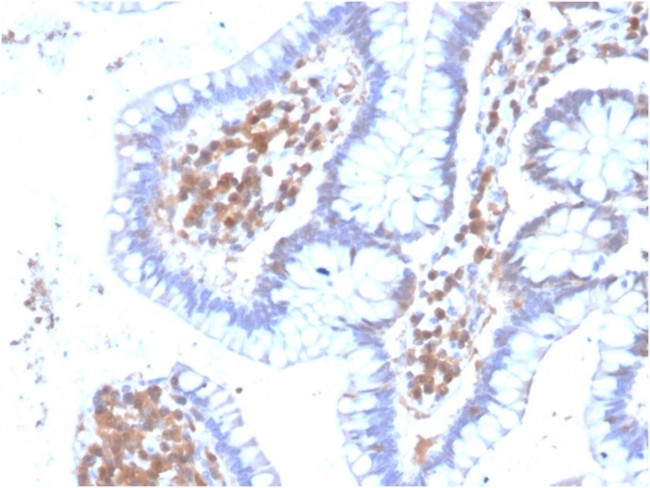MAPK14 Antibody in Immunohistochemistry (Paraffin) (IHC (P))