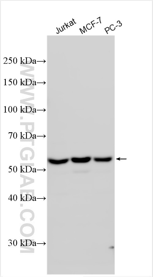 TSEN54 Antibody in Western Blot (WB)