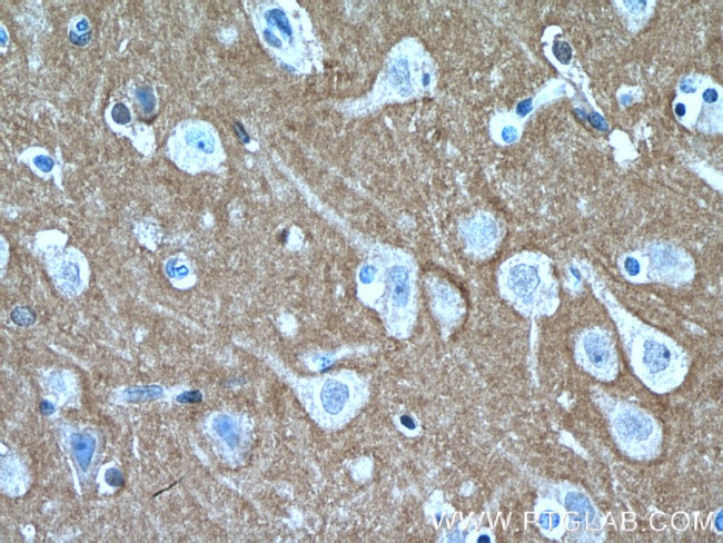 RHOB Antibody in Immunohistochemistry (Paraffin) (IHC (P))