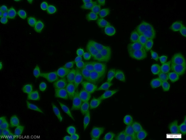 NOMO2 Antibody in Immunocytochemistry (ICC/IF)