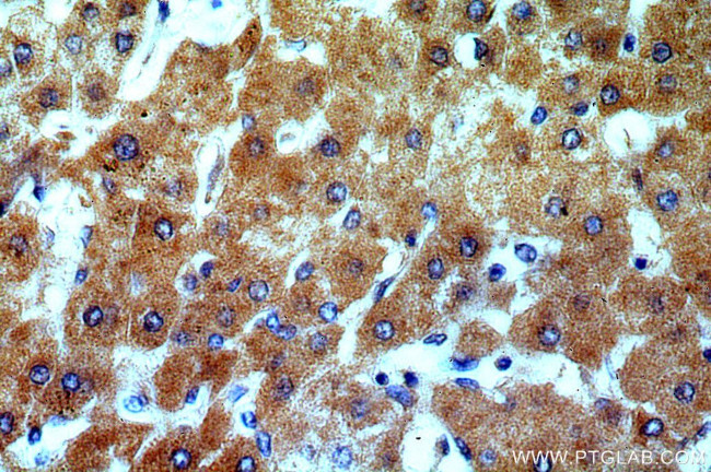 TSPAN33 Antibody in Immunohistochemistry (Paraffin) (IHC (P))