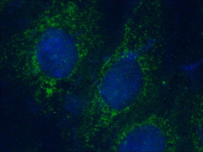 KIF3C Antibody in Immunocytochemistry (ICC/IF)