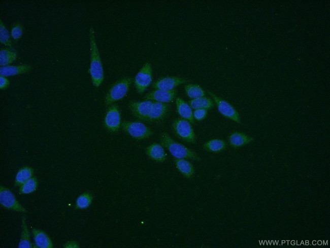 MAPKAPK5 Antibody in Immunocytochemistry (ICC/IF)