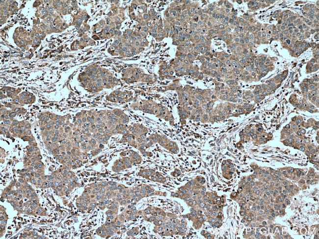 PALB2 Antibody in Immunohistochemistry (Paraffin) (IHC (P))