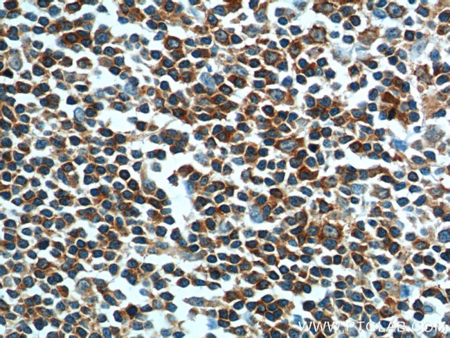 ARHGAP25 Antibody in Immunohistochemistry (Paraffin) (IHC (P))