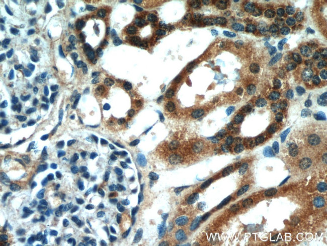 HS3ST1 Antibody in Immunohistochemistry (Paraffin) (IHC (P))