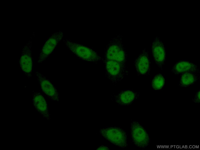 RBM6 Antibody in Immunocytochemistry (ICC/IF)