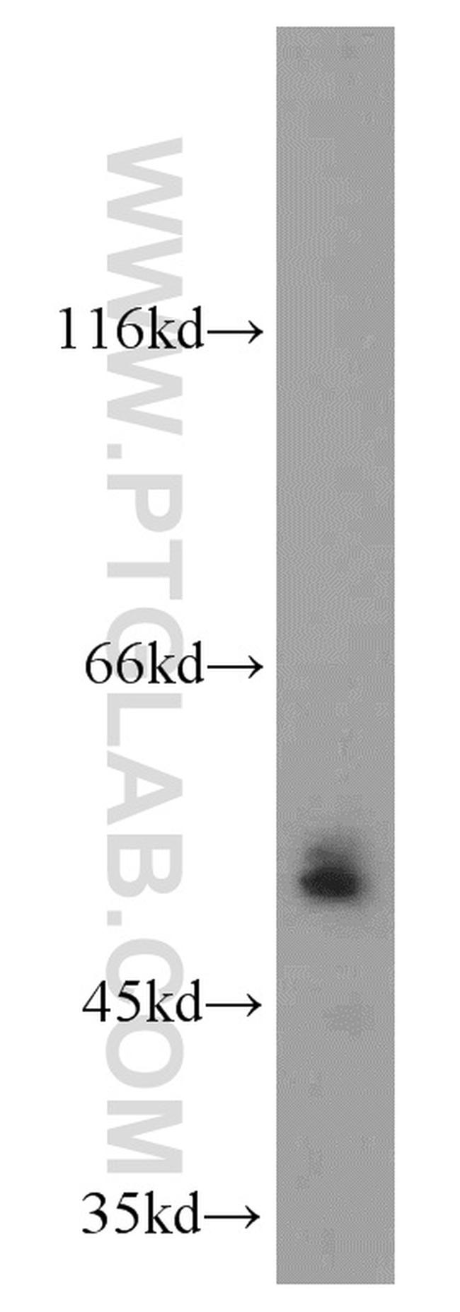 Adiponectin receptor Antibody in Western Blot (WB)