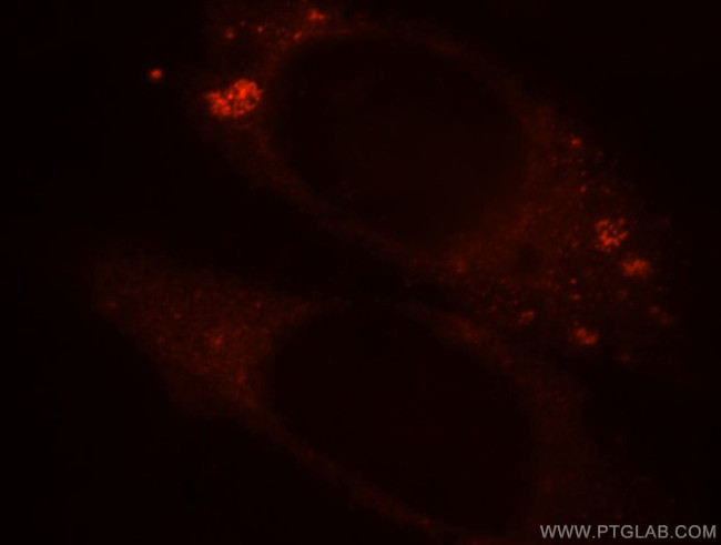 BPI Antibody in Immunocytochemistry (ICC/IF)
